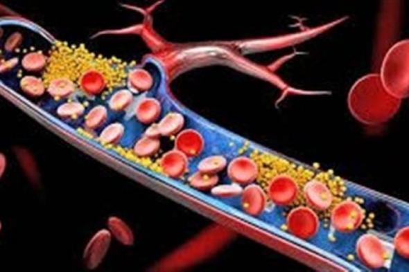 بالبلدي : ارتفاع الكوليسترول السيئ بسبب نقص هذا الفيتامين.. تعرف على فوائده ومصادره الغذائية