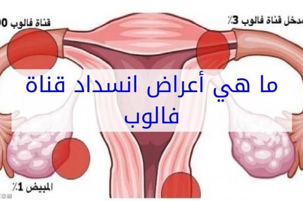 اعراض انسداد الانابيب وقت الدورة وبعد الولادة القيصرية: علاج الانسداد في المنزل بالاعشاب