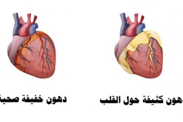 خبير: لهذه الأسباب "سمنة القلب" خطر على مناعة الإنسان