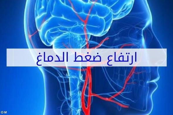 اسباب ارتفاع ضغط الدماغ وطرق الوقاية منه بالتفصيل