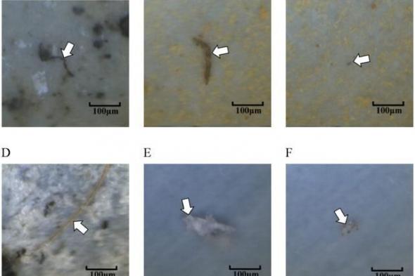 اللدائن البلاستيكية الدقيقة تسبب مشاكل صحية