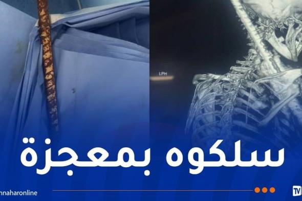 صور صادمة: قضيب حديدي إخترق جسمه.. الأطباء ينقذون عامل بأعجوبة