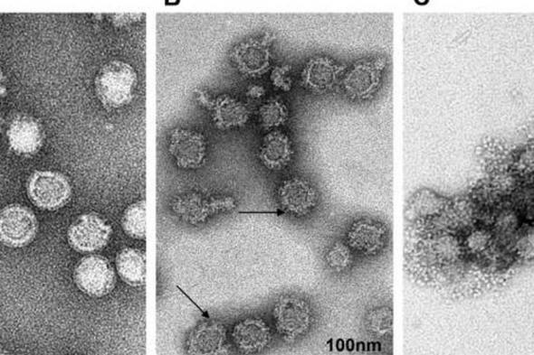 فيروس فتاك يصل بريطانيا يسبب التهاب الدماغ.. أعراضه وكيفية الوقاية
